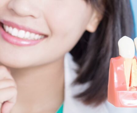 Dental Inserts in Menifee